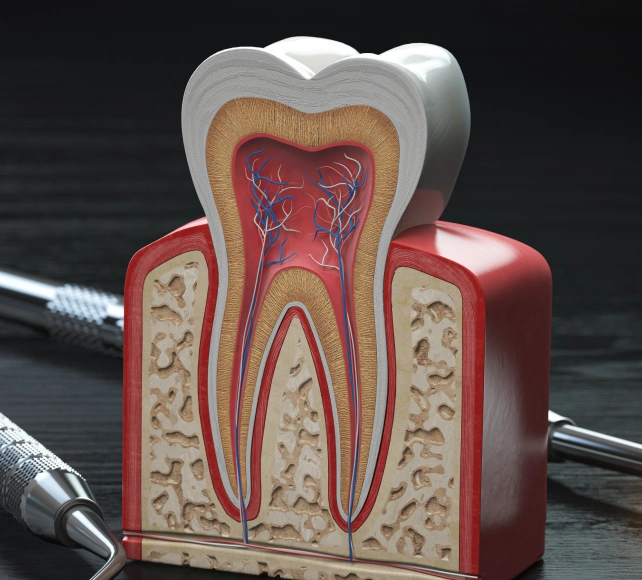 Root canals